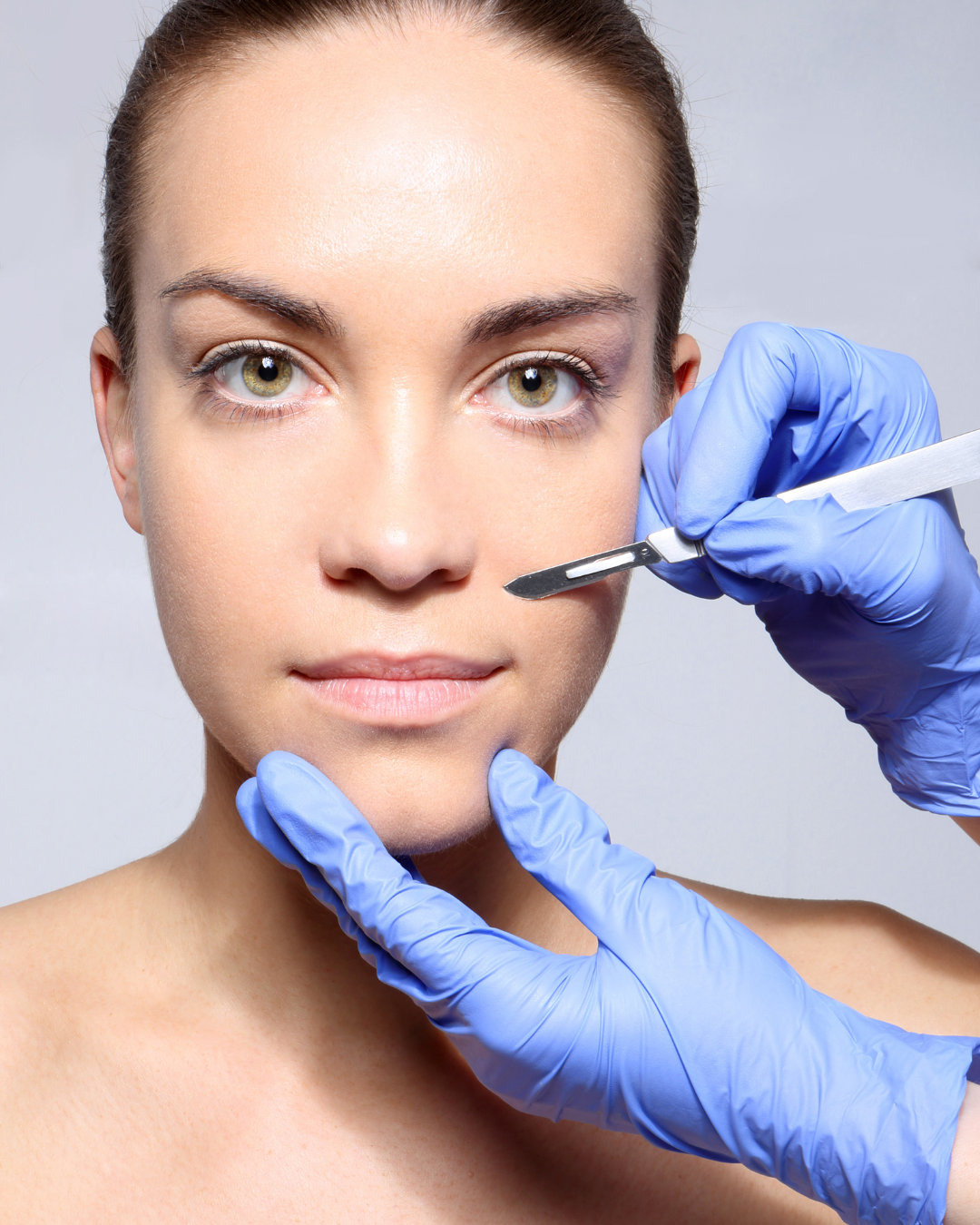 Mechanical (Physical) Peel — About the treatment