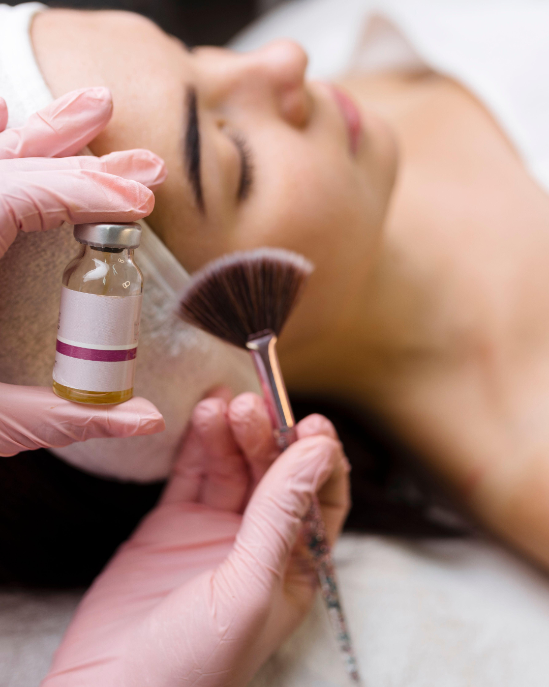 Chemical Peel